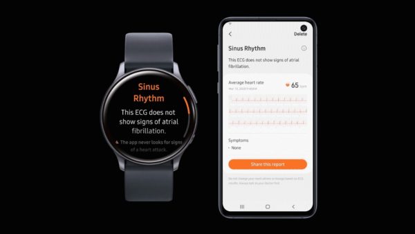 Samsung Galaxy Watch Active 2 - Health Monitor App Showing ECG Function